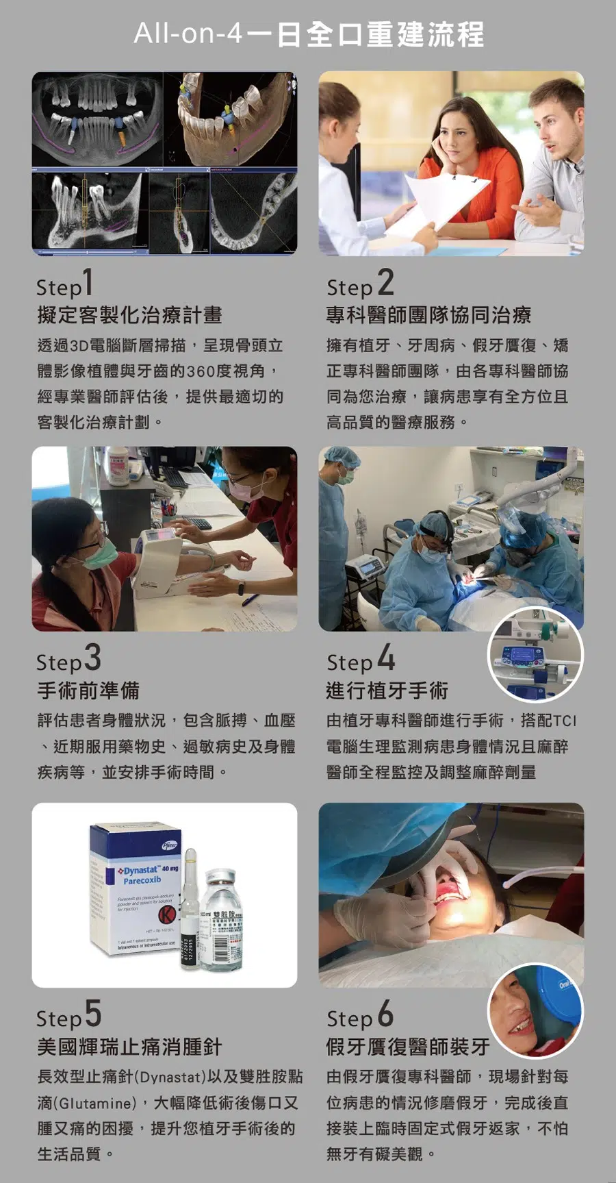 All-on-4一日全口重建