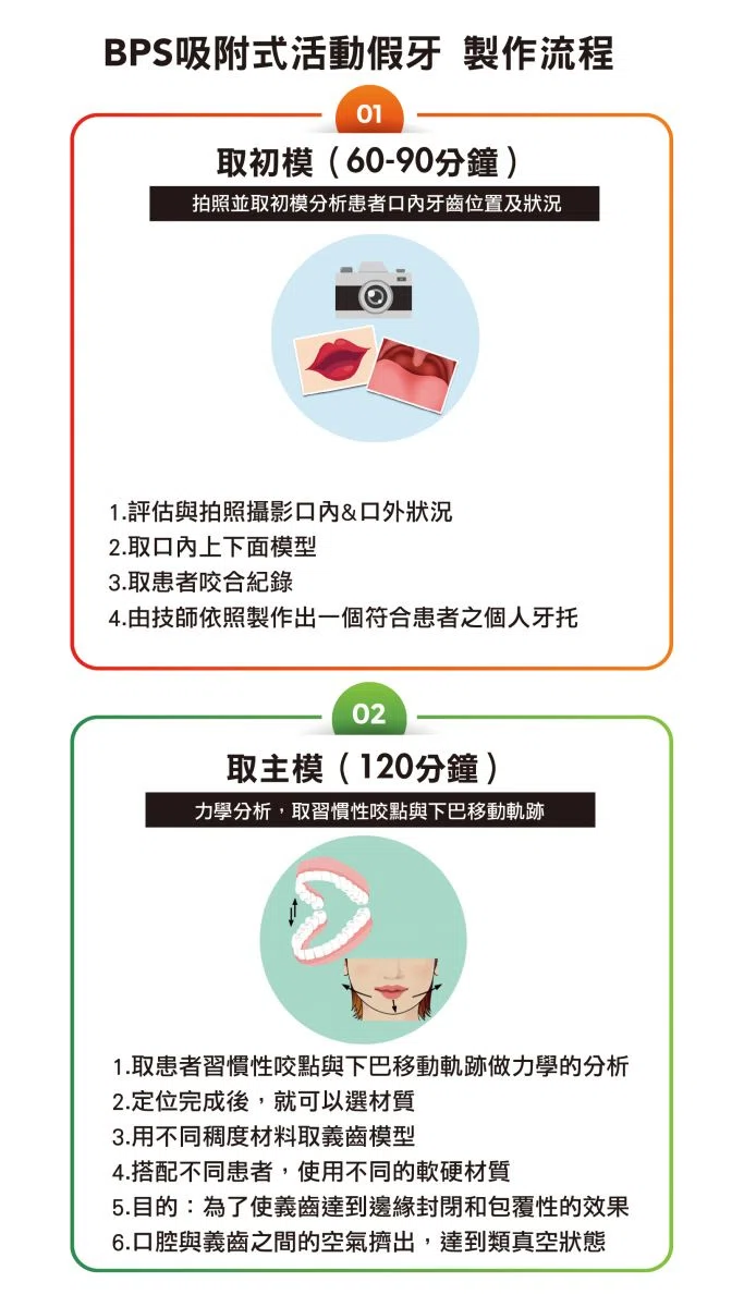 BPS吸附式活動假牙 BPS吸附式活動假牙