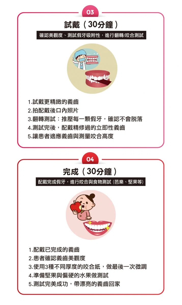 BPS吸附式活動假牙 BPS吸附式活動假牙