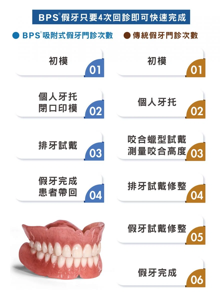 BPS吸附式活動假牙 BPS吸附式活動假牙
